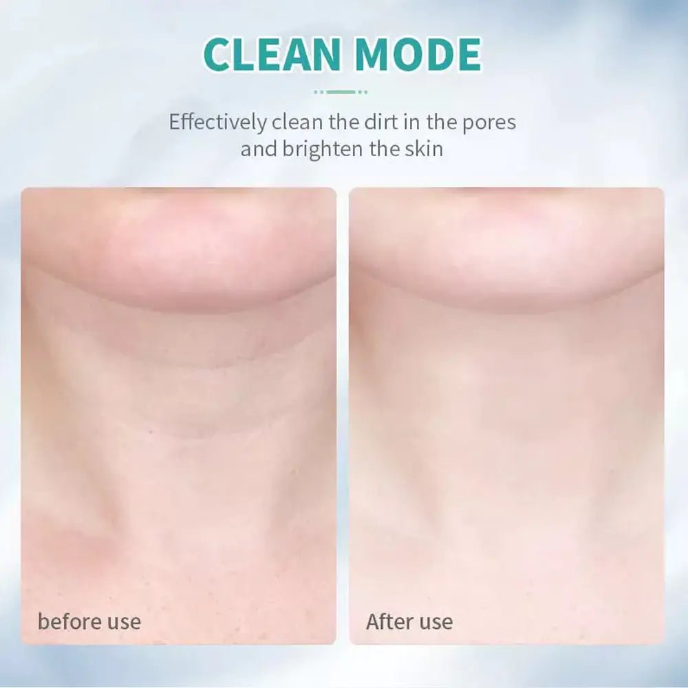 SmoothPro | Appareil de massage facial et cervical anti - rides et lifting - Soliqlo